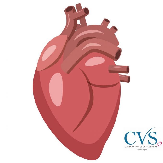 Cardiac Vascular Sentral (Kuala Lumpur)